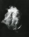 Swelling, Vanessa R. Thompson, 14x18, silver gelatin, $600